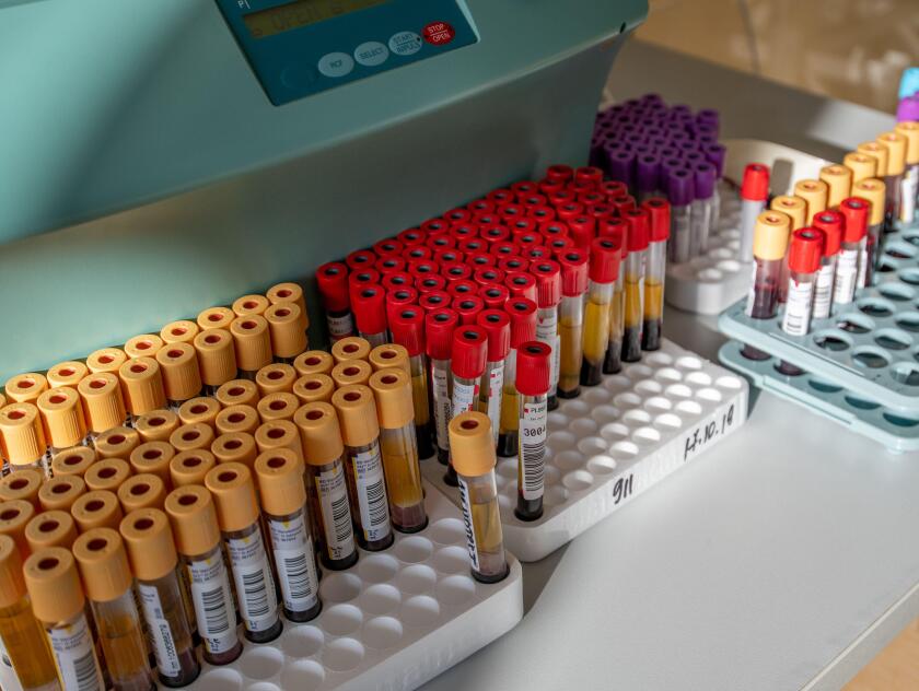 Moscow, Russia - Oct 25. 2019. The BD Vacutainer tubes from Becton Dickinson International with patient blood