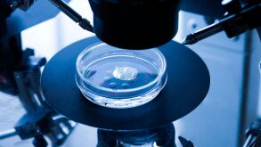 ivf.jpg
