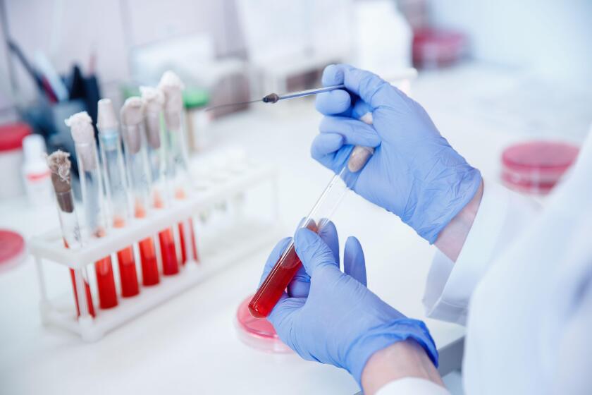 Woman medic working with blood sample in laboratory, blue color